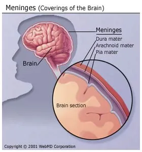 Bacterial Meningitis Symptoms Adults