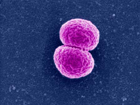 Bacterial Meningitis Symptoms Contagious