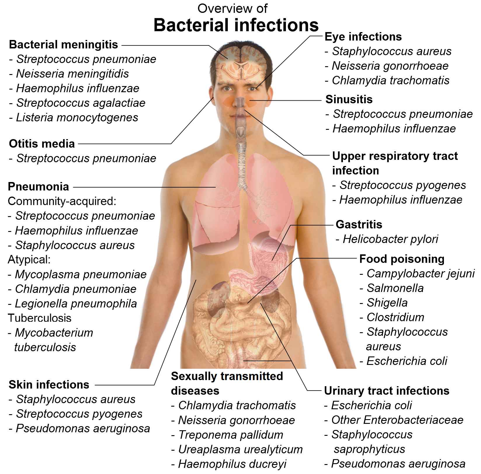 Bacterial Meningitis Symptoms Contagious